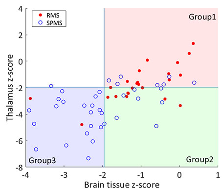 Kuvio: Tutkimukseen osallistuneiden potilaiden jakautuminen eri ryhmiin aivoatrofian perusteella. 