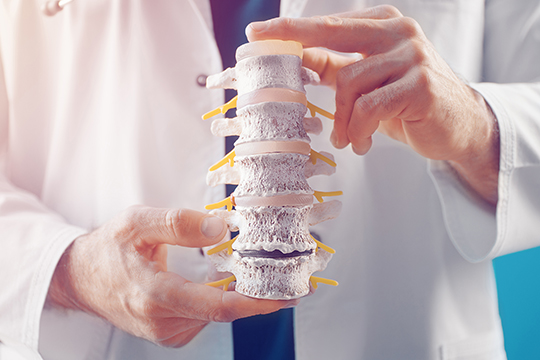 Osteoporoosi1_540.jpg
