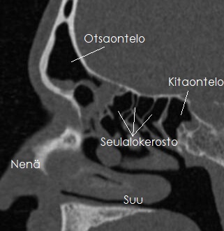 Nenän ontelot.jpg