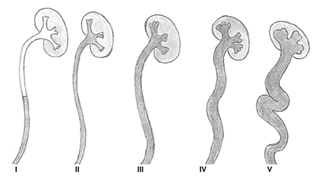 Äitini pakotti minut seksiä hänen kanssaan